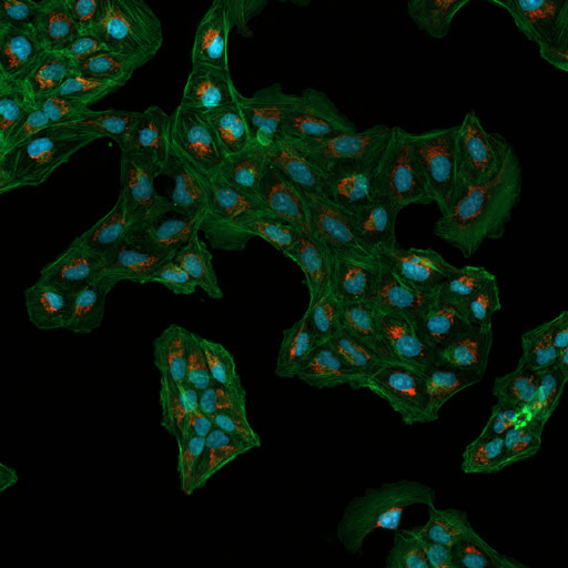 Nuclei Segmentation with Fiji